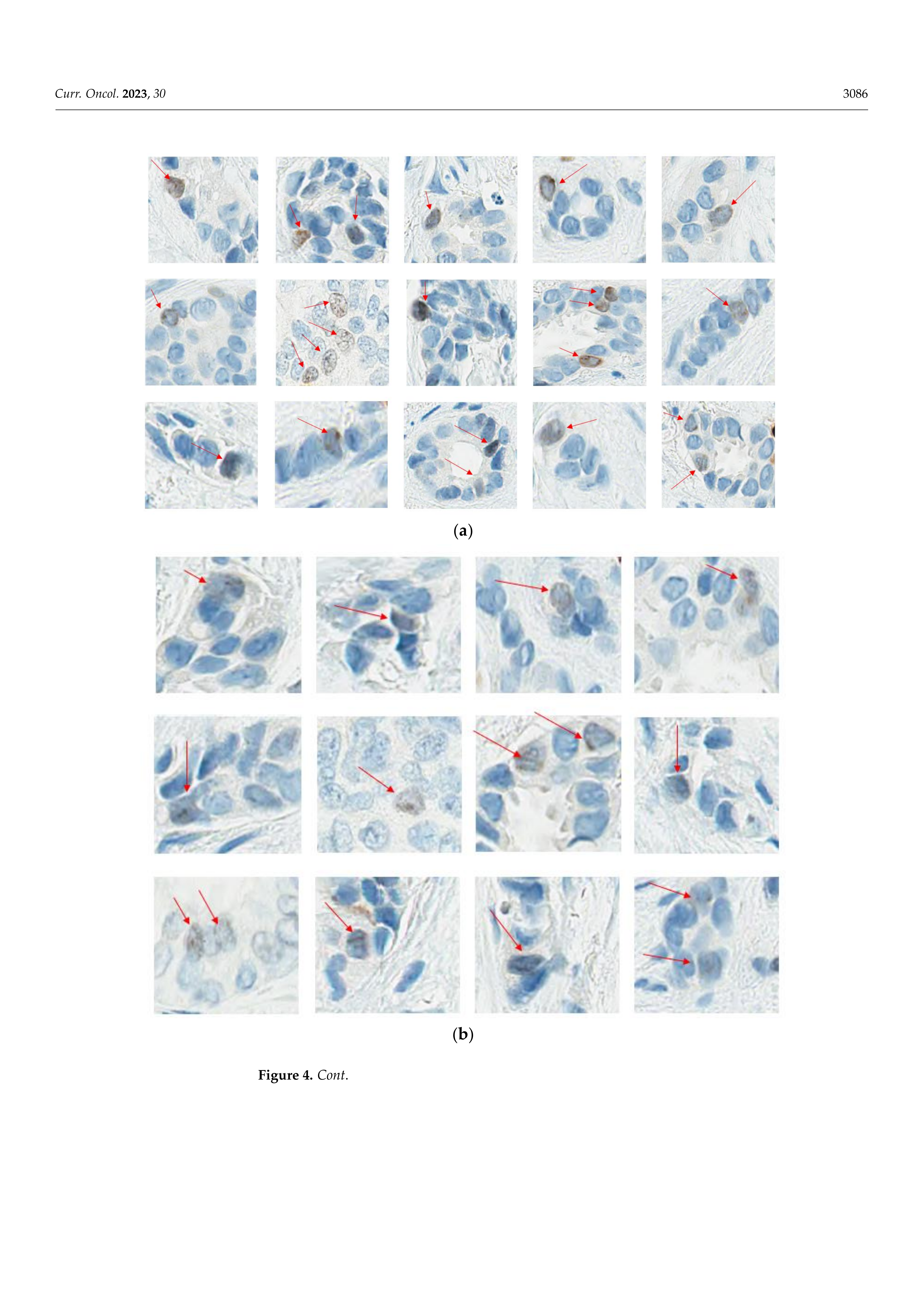 Ki67 In Breast Cancer Assay: An Ad Hoc Testing Recommendation From The Canadian Association Of Pathologists Task Force